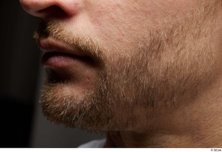 HD Face Skin Erling bearded cheek chin face facial hair…